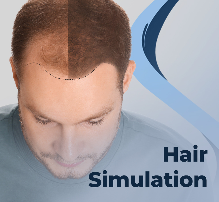 Hair Simulation